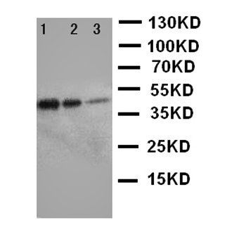 ErbB 3/ERBB3 Rabbit Polyclonal Antibody