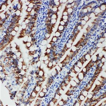 Tyrosine-protein kinase Fer FER Rabbit Polyclonal Antibody