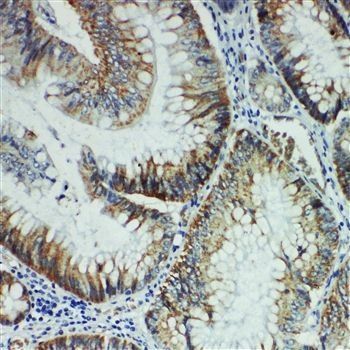 Tyrosine-protein kinase Fer FER Rabbit Polyclonal Antibody