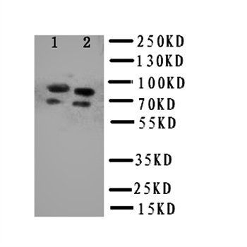 Tyrosine-protein kinase Fer FER Rabbit Polyclonal Antibody