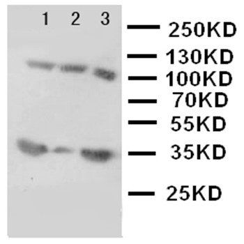 Bone Sialoprotein/IBSP Rabbit Polyclonal Antibody
