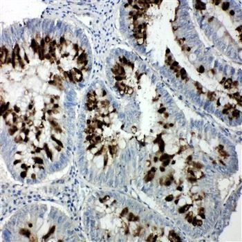 p107/RBL1 Rabbit Polyclonal Antibody