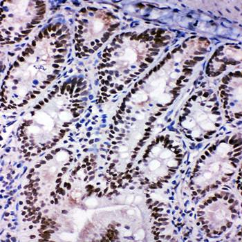 SHC/SHC1 Rabbit Polyclonal Antibody