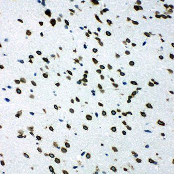 SHC/SHC1 Rabbit Polyclonal Antibody