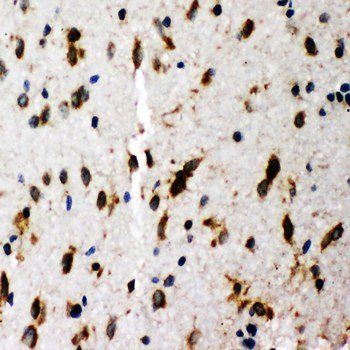 SHC/SHC1 Rabbit Polyclonal Antibody
