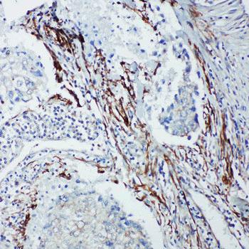 SHC/SHC1 Rabbit Polyclonal Antibody
