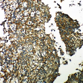 TXNRD2 Rabbit Polyclonal Antibody