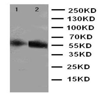Cytochrome P450 2E1/CYP2E1 Rabbit Polyclonal Antibody