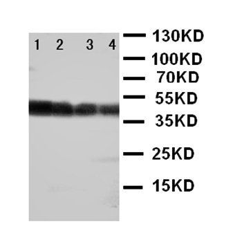 Delta-like protein 3 DLL3 Rabbit Polyclonal Antibody