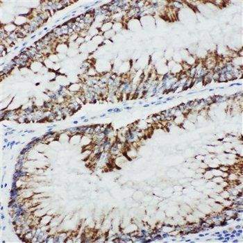 MEKK1/MAP3K1 Rabbit Polyclonal Antibody