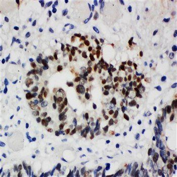 Nucleophosmin/NPM1 Rabbit Polyclonal Antibody