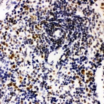 Nucleophosmin/NPM1 Rabbit Polyclonal Antibody