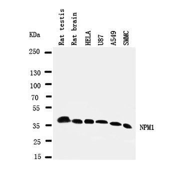 Nucleophosmin/NPM1 Rabbit Polyclonal Antibody