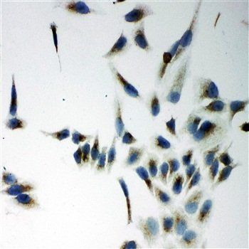 NADPH oxidase 5 NOX5 Rabbit Polyclonal Antibody