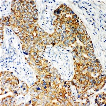 NADPH oxidase 5 NOX5 Rabbit Polyclonal Antibody