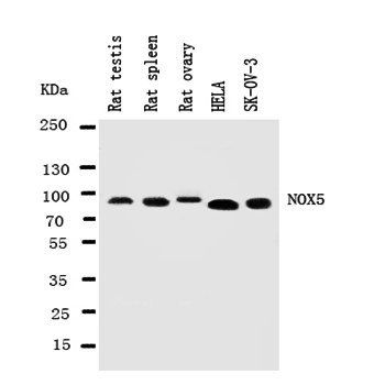 NADPH oxidase 5 NOX5 Rabbit Polyclonal Antibody