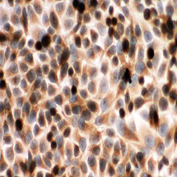 Cytochrome P450 Reductase/POR Rabbit Polyclonal Antibody