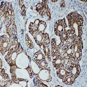 Tight junction protein ZO-2 TJP2/ZO Rabbit Polyclonal Antibody