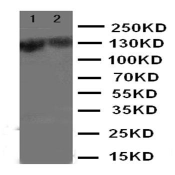 Smad Interacting Protein 1/ZEB2 Rabbit Polyclonal Antibody
