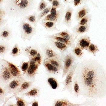 DDX4/MVH Rabbit Polyclonal Antibody