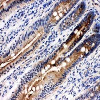 DDX4/MVH Rabbit Polyclonal Antibody