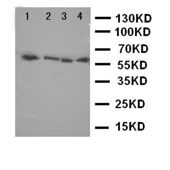 LCAT Rabbit Polyclonal Antibody