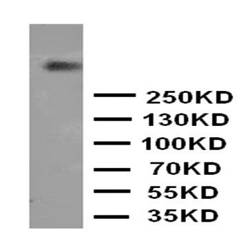 DNA PKcs/PRKDC Rabbit Polyclonal Antibody