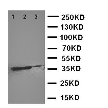 DR4/TNFRSF10A Rabbit Polyclonal Antibody