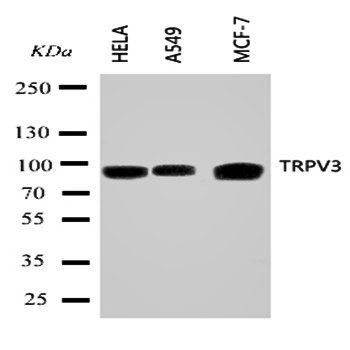 TRPV3 Rabbit Polyclonal Antibody