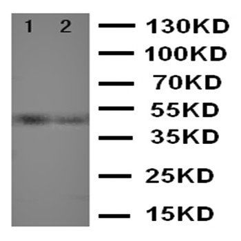 Vitamin D Receptor/VDR Antibody
