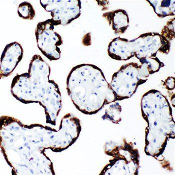 Growth Hormone/GH1 Rabbit Polyclonal Antibody