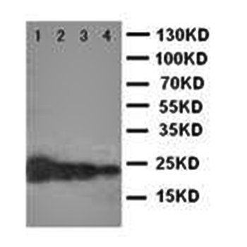 Growth Hormone/GH1 Rabbit Polyclonal Antibody