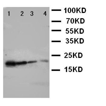 Growth Hormone/GH1 Rabbit Polyclonal Antibody