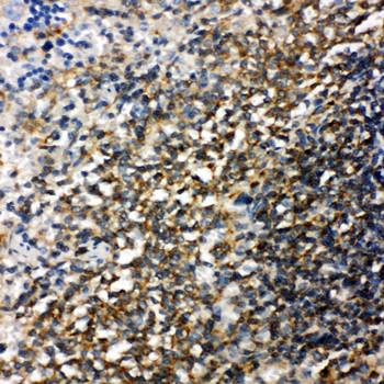 Bid Rabbit Polyclonal Antibody