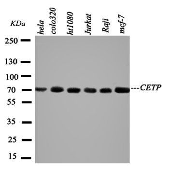 CETP Rabbit Polyclonal Antibody