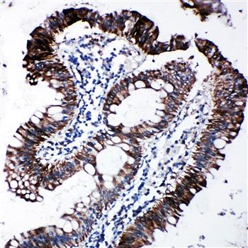 EIF2S1 Rabbit Polyclonal Antibody