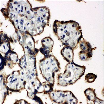 EIF2S1 Rabbit Polyclonal Antibody