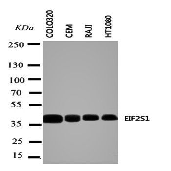 EIF2S1 Rabbit Polyclonal Antibody
