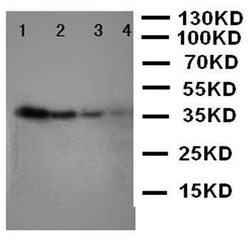 NTAL/LAT2 Rabbit Polyclonal Antibody