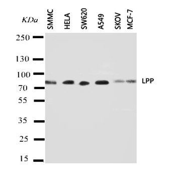 Lipoma-preferred partner LPP Rabbit Polyclonal Antibody