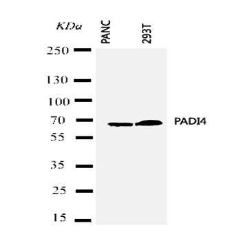PADI4/PAD4 Rabbit Polyclonal Antibody