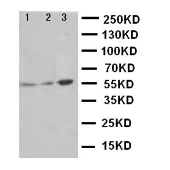 PKM2 Rabbit Polyclonal Antibody