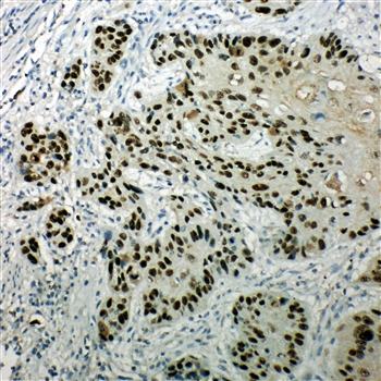 p63/TP63 Rabbit Polyclonal Antibody