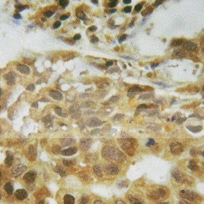 p53 Antibody