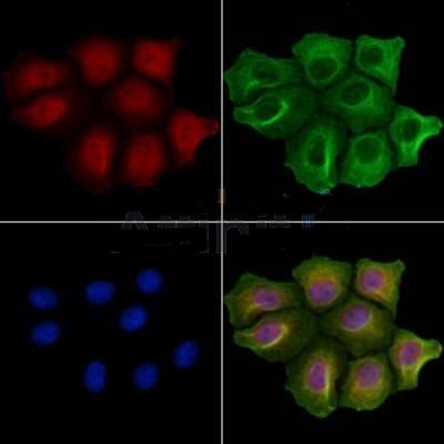 p53 Antibody