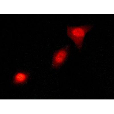p53 Antibody