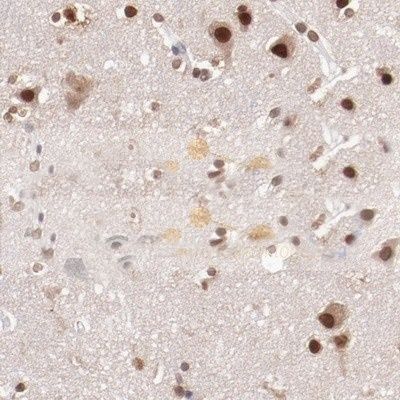 pan-AKT1/2/3 Antibody