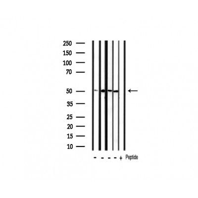 pan-AKT1/2/3 Antibody