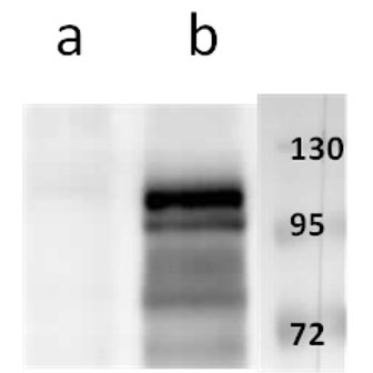 Anti-ORF11 (VZV) antibody