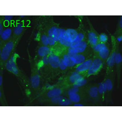 Anti-ORF12 (VZV) antibody